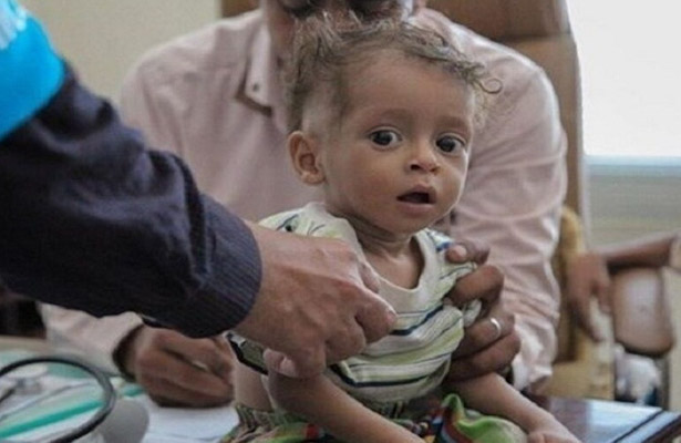 Мировая продовольственная программа ООН предупреждает о смерти миллионов йеменцев