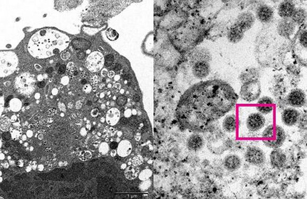 Ученые из Гонконга опубликовали первую фотографию «омикрона»