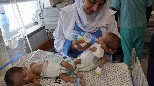 Палестинский доктор рассказал об условиях работы в больнице Газы
